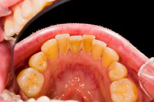 0d3cd2 07a46d7c28114471b7a40fbb51b1b53e mv2