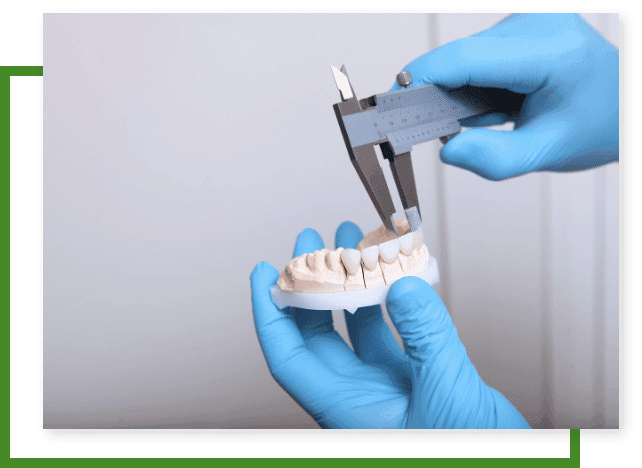 Benefits Of Composite Veneers