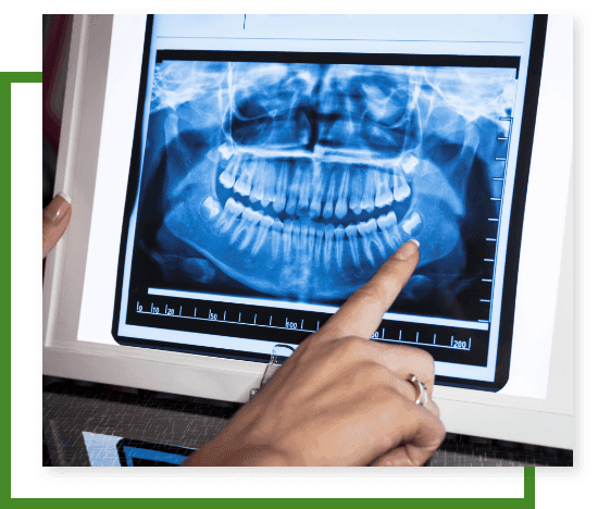 Dental Radiography