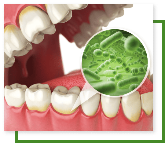 gum disease